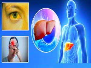 लीवर खराब होने से पहले शरीर देता है ये 2 संकेत