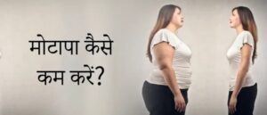 दिन प्रतिदिन बढता ही जा रहा था इस औरत का पेट, 20 चिकित्सकों की कडी मशक्कत के बाद पता चली सच्चाई