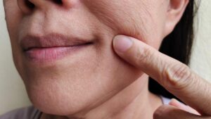 चेहरे की स्किन को टाइट करने के तरीके के बारे में जानने के लिए अभी पढ़े आप चेहरे की स्किन को टाइट करने के तरीके के बारे में जानने के लिए अभी पढ़े आप