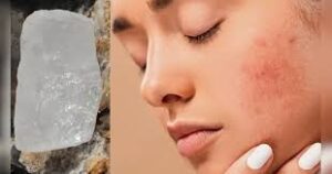 फिटकरी और गुलाब जल के फायदे जानकर आप रह जाएंगे हैरान