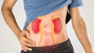 ये आपकी सामान्य आदतें जो किडनी को नुकसान पहुंचा सकती है ये आपकी सामान्य आदतें जो किडनी को नुकसान पहुंचा सकती है