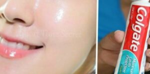 कोलगेट से 5 मिनट में चेहरे को चांद सा गोरा और सुंदर बनाए जानिए कैसे कोलगेट से 5 मिनट में चेहरे को चांद सा गोरा और सुंदर बनाए जानिए कैसे