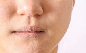 समय के साथ साथ क्या आप की त्वचा रूखी और बेजान हो रही है