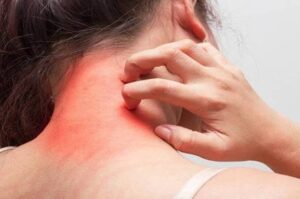 खुजली की समस्या को जड़ से खत्म कर देगा ये रामबाण उपाय